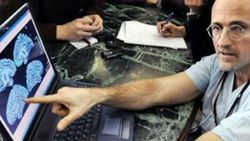 Çin'de ilk kafa nakli başarıyla yapıldı