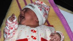 40 günlük Dicle bebek yaşam savaşını kazandı