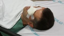 Samsun’da vurulan arkadaşını tedavi eden doktoru dövdü