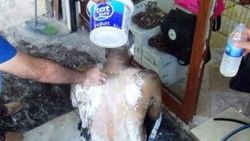 Şanlıurfa'da bir genç kendini yaktı