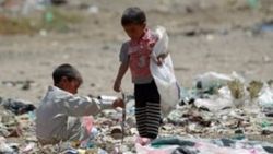 Yemen'de çocuklar açlıktan ölmeye devam ediyor