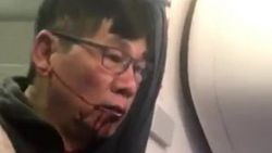 Darp edilen United Airlines yolcusu iki avukat tuttu