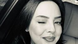 Ebru Gündeş de köfte dudak oldu