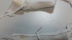 Havalimanında bacak arasında eroinle yakalandı