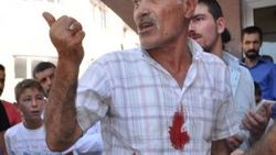 Erzurum'da sigara kavgası