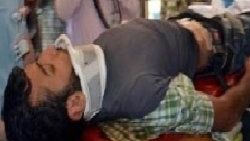 Yaralı PKK'lıya ilk müdahale Mehmetçik'ten
