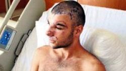 Can kurtaran botunun pervanesi yüzünü parçaladı