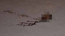 Kesik baş cinayetinin nedeni ortaya çıktı