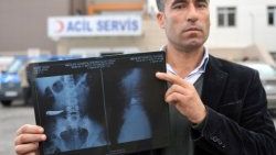 9 yıl karnında bıçakla yaşadı