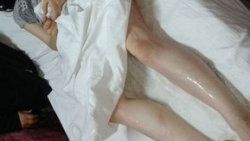 Eski karısını kızgın yağla haşlayan adam yakalandı