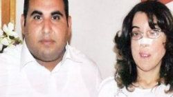 Yüz nakli beklerken aşık oldu