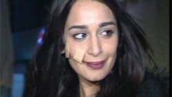 Beril Kayar'ın yüzüne ne oldu