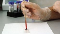 Bu test ne zaman öleceğimizi söylüyor