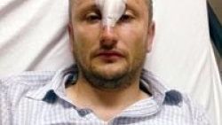 Kendisini sivil polislerin bu hale getirdiğini iddia etti
