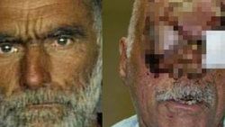 Yamyamın saldırdığı adamın ilk görüntüleri