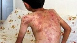 İki çocuğa işkence yapan çocuklar yakalandı