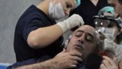 Mahmut Tuncer saç ektirdi
