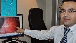 Gözünden çıkan 10 cm'lik parazit şaşırttı