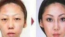 Çin'de çirkin çocuk doğurunca gerçekler ortaya çıktı