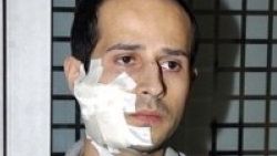 Doktora jiletli saldırı