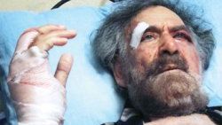 Elleri kırılan çizere ödül geldi