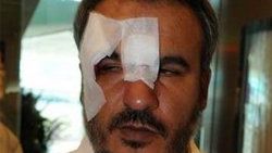 Uçakta küfür kavgası: 4 yaralı