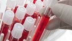 Hangi kan grubunun IQ'su daha yüksek