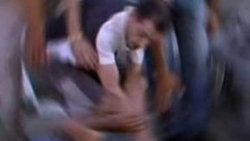 Hastane sapığına dayak