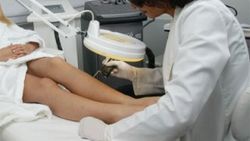 Lazer epilasyon estetisyene yasaklanıyor