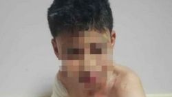 Tartıştığı komşusu ve çocuklarına kezzap attı