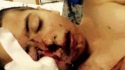 İsrail polisi 5 yaşındaki Filistinli çocuğu vurdu