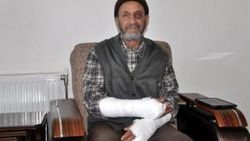 Yaşlı adama saldırıp kollarını kırdılar