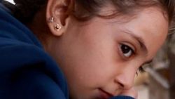 7 yaşındaki Bana Türkiye'ye getirilecek