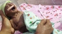 Hindistan'da hasta doğan bebeği anne ve babası terk etti