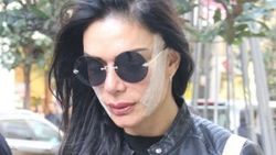 Sevda Demirel Kim Kardashian ameliyatı oldu