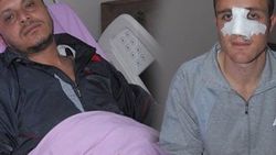İzmir'de AK Partililer'e saldırı