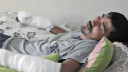 Çanakkale'de kangal hastanelik etti