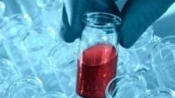 HIV tedavisinde kötü gelişme