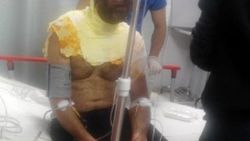 Eşine kızıp kendini yaktı
