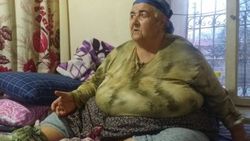 185 kilo kadın tedavi için yardım bekliyor