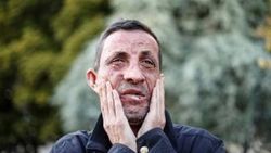 Türkiye'nin ilk yüz nakli olan hastası: Rüya gibi