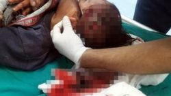 4 yaşındaki çocuk köpeğin saldırısına uğradı