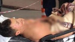 15 yaşındaki Ömer, çatıda akıma kapılarak ağır yaralandı