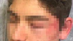 Çocuğu boks makinesi yerine koyup dövdü, tutuklandı