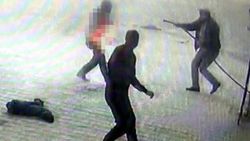 Kendini tutuşturan adamı hortumla söndürdüler