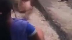 Kızgın kömürlerin içine düşen kadın ölümden döndü