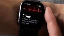 Apple Watch'un EKG özelliği Avrupa ülkeleri için yayınlandı