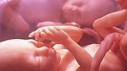 Çin'de ikizlerin babaları farklı kişiler çıktı