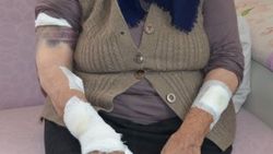 Köpeklerin saldırdığı kadını ölümden komşuları kurtardı