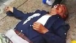 Karşıdan karşıya geçmek isterken tramvay çarptı